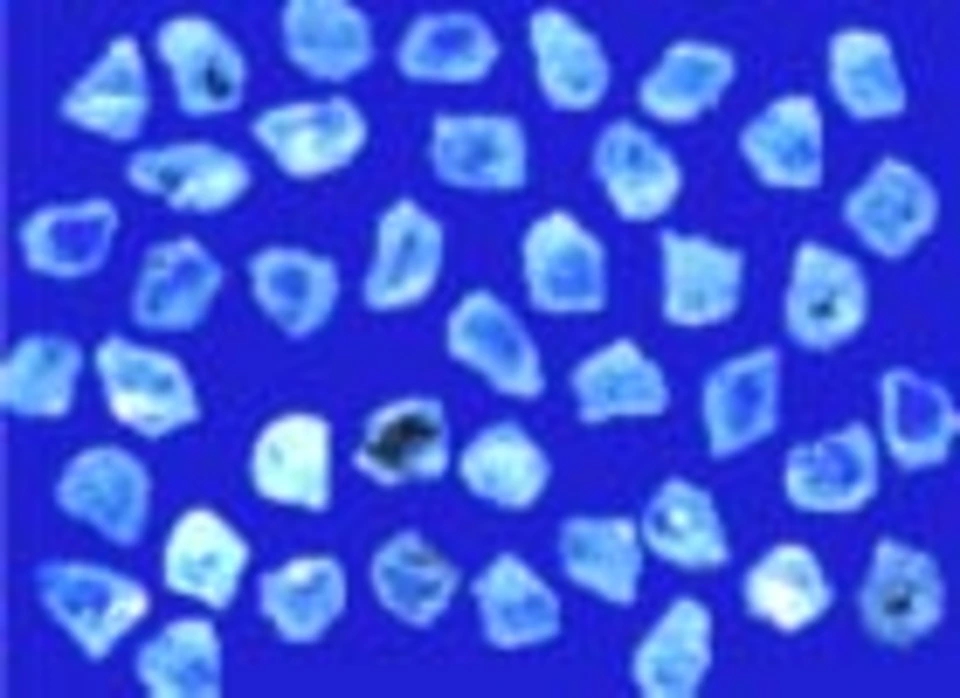 NAT - MB 70/80 à 400/500